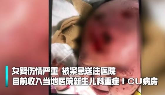 三个月大的女婴头皮被啃露出骨头，给养宠物带来了什么启示？